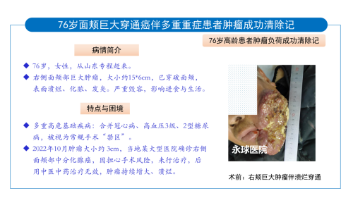 永球医院案例剖析1_02