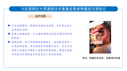 永球医院案例剖析1_04
