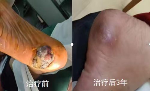 eec27dd393349088b00205b6ee9b6209